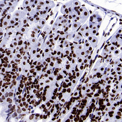 Histone H4 (acetyl K5 + K8 + K12 + K16) Recombinant Rabbit mAb (S-902-37)