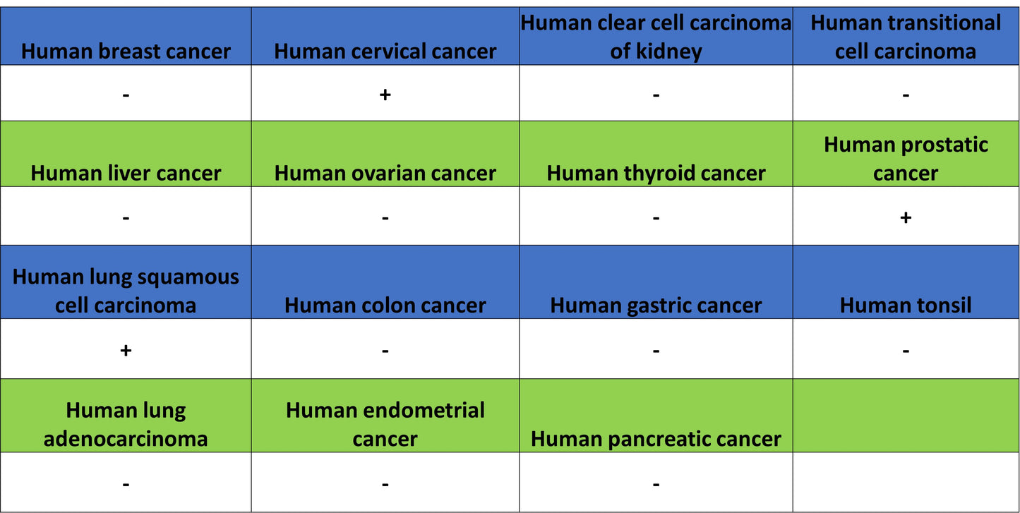 Aass Recombinant Rabbit mAb (S-4170-22)