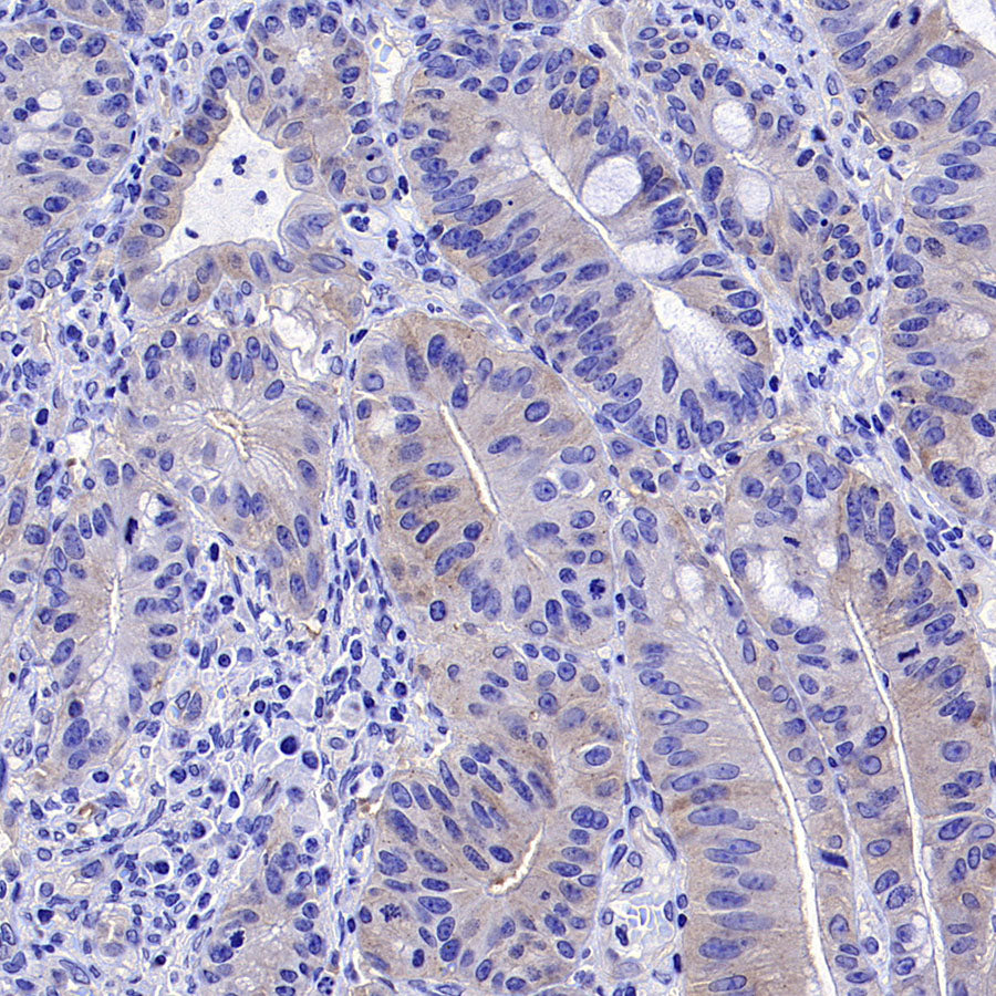 Phospho-Acetyl-CoA Carboxylase (Ser79) Recombinant Rabbit mAb (S-4302)
