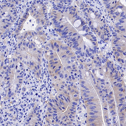 Phospho-Acetyl-CoA Carboxylase (Ser79) Recombinant Rabbit mAb (S-4302)