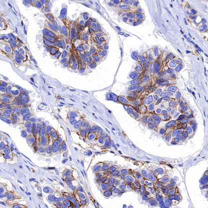 CD44 Recombinant Rabbit mAb (S-944-25)