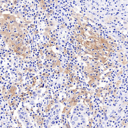 Noxa Recombinant Rabbit mAb (S-5505)