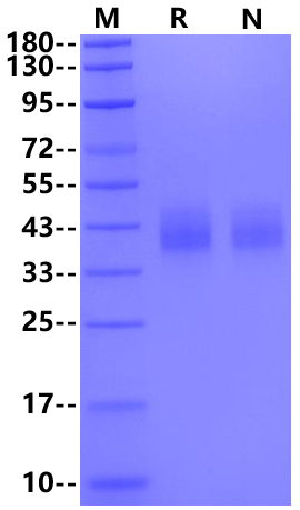 IL-21 R His Tag Protein, Human