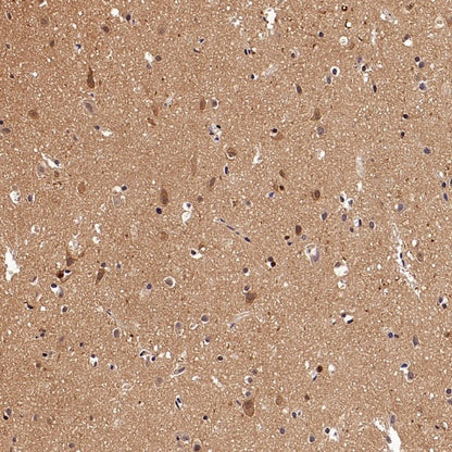 PSMB5 Rabbit Polyclonal Antibody