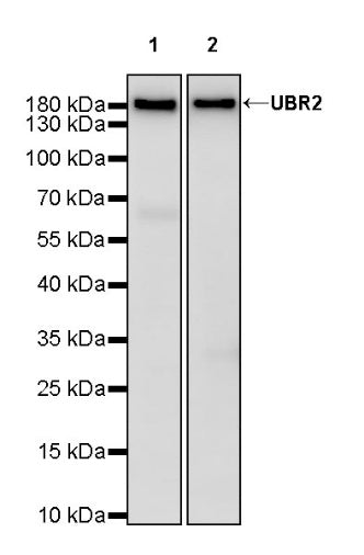 UBR2 Recombinant Rabbit mAb (S-2041-163)