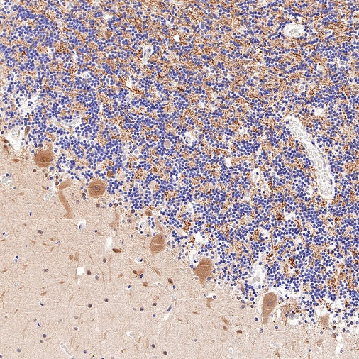 PGP9.5 Recombinant Rabbit mAb (SDT-665-37)