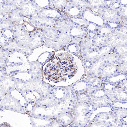 PDGFRA+PDGFRB Recombinant Rabbit mAb (S-393-11)