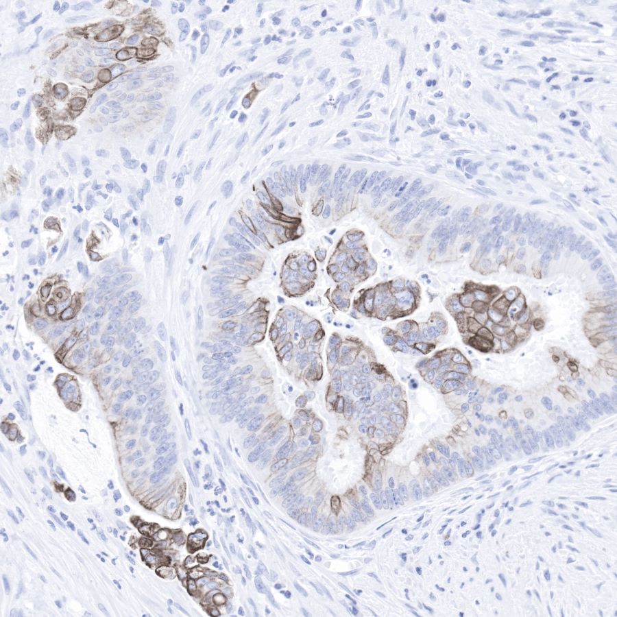 Keratin 20 Recombinant Rabbit mAb (SDT-013-18)