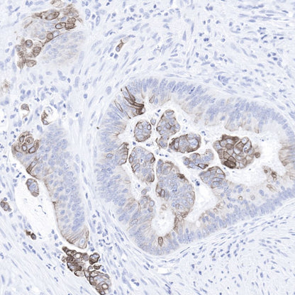 Keratin 20 Recombinant Rabbit mAb (SDT-013-18)