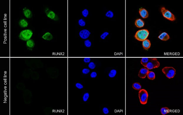 Runx2 Recombinant Rabbit mAb (S-1767-173)