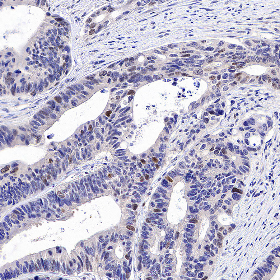 ATAD2 Recombinant Rabbit mAb (S-4145-63)