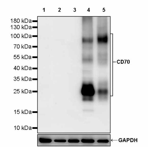 CD70 Recombinant Rabbit mAb (S-1725-277)