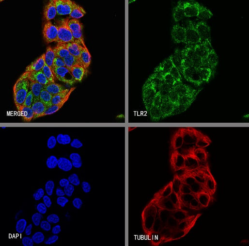 UQCRC2 Recombinant Rabbit mAb (S-1890-227)