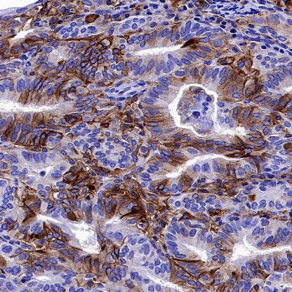 CMTM6 Recombinant Rabbit mAb (S-2013-4)