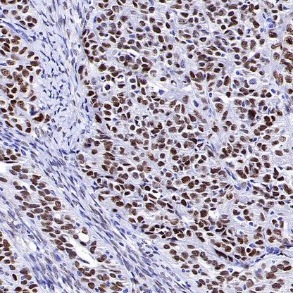 Wilms Tumor Protein (WT1) Recombinant Rabbit mAb (SDT-2864)