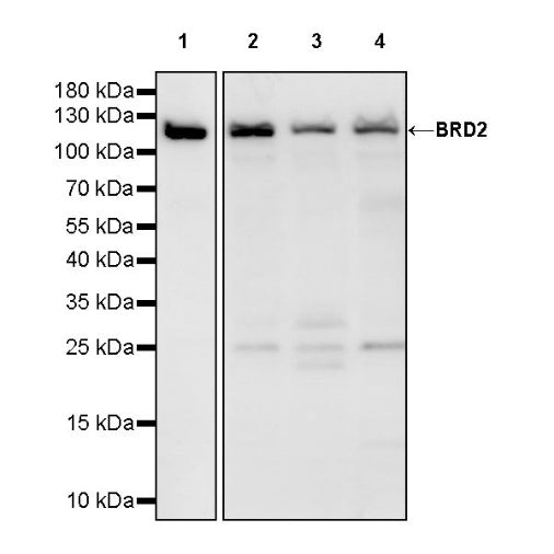 BRD2 Recombinant Rabbit mAb (S-1889-4)