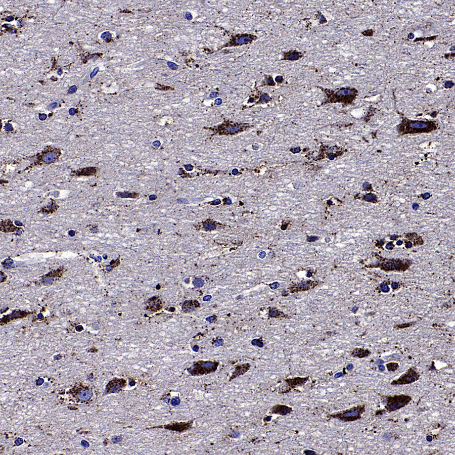 Galactosylceramidase Recombinant Rabbit mAb (S-3402-17)