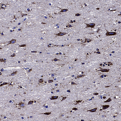 Galactosylceramidase Recombinant Rabbit mAb (S-3402-17)