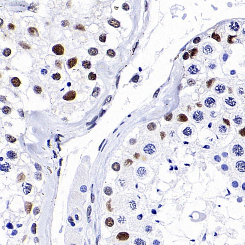 CDK9 Rabbit Polyclonal Antibody