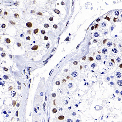CDK9 Rabbit Polyclonal Antibody