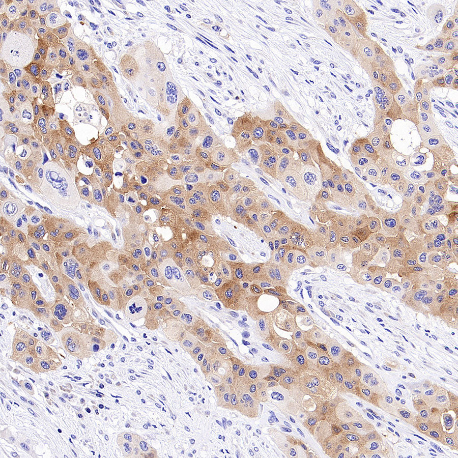 STK39 Recombinant Rabbit mAb (S-3630-15)