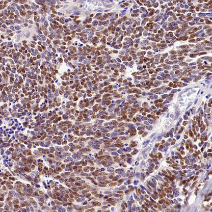 INSM1 Recombinant Rabbit mAb,PBS Only (SDT-3165-72)