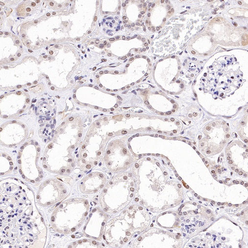 TDG Recombinant Rabbit mAb (S-3111-16)