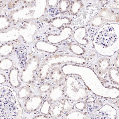 TDG Recombinant Rabbit mAb (S-3111-16)