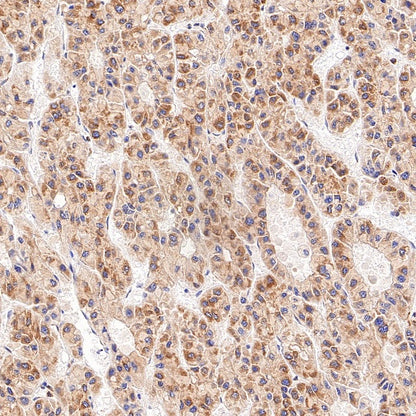 Sec61B Recombinant Rabbit mAb (S-4499-3)