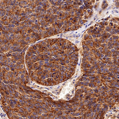 Flotillin 1 Rabbit Polyclonal Antibody