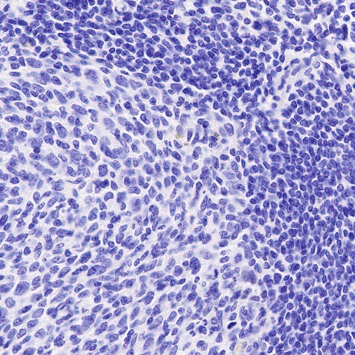 SAGE1 Recombinant Rabbit mAb (SDT-317-60)