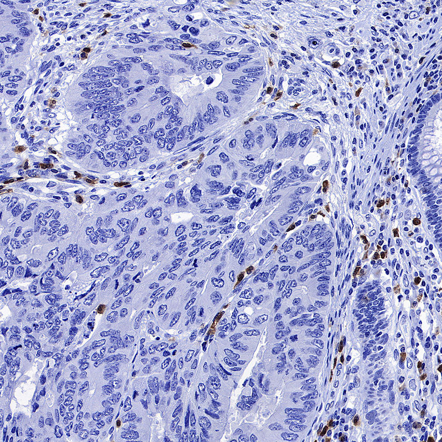 CD127 Recombinant Rabbit mAb (S-4826)
