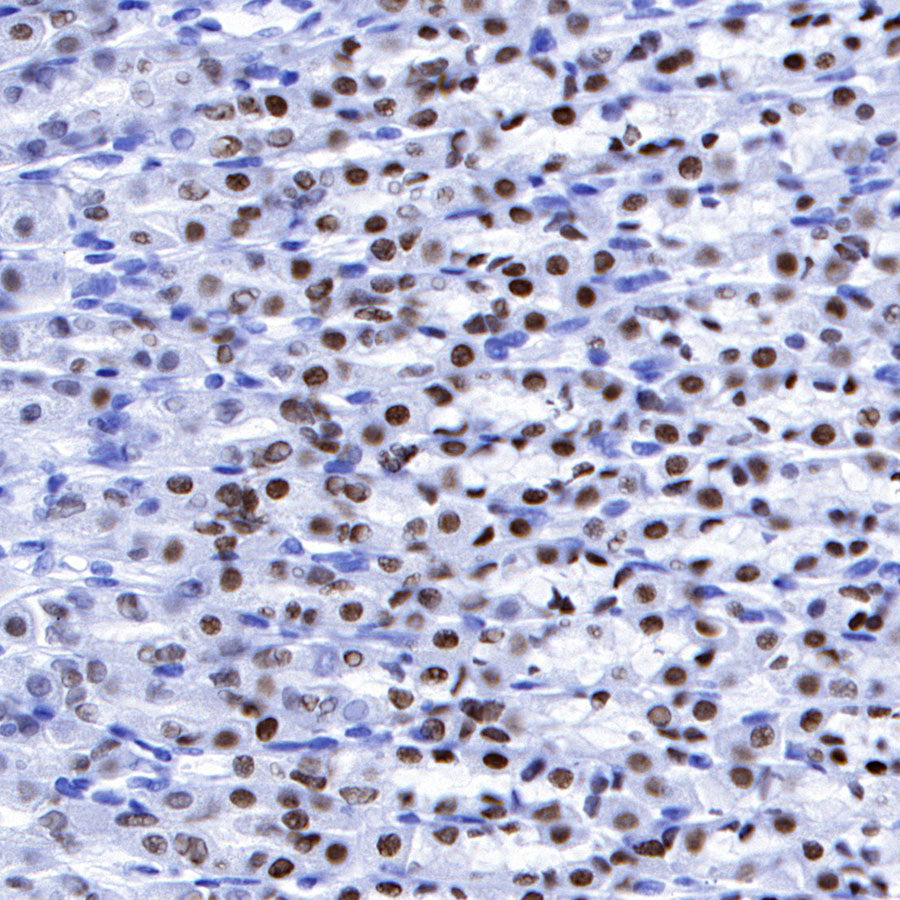 FOXA2 Recombinant Rabbit mAb (SDT-R174)