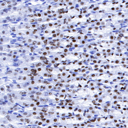 FOXA2 Recombinant Rabbit mAb (SDT-R174)
