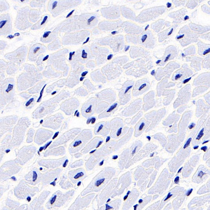 S-RMab® FSHB Recombinant Rabbit mAb (SDT-544-22)