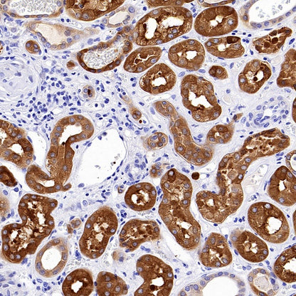 ALDH1L1 Recombinant Rabbit mAb (S-2885-49)