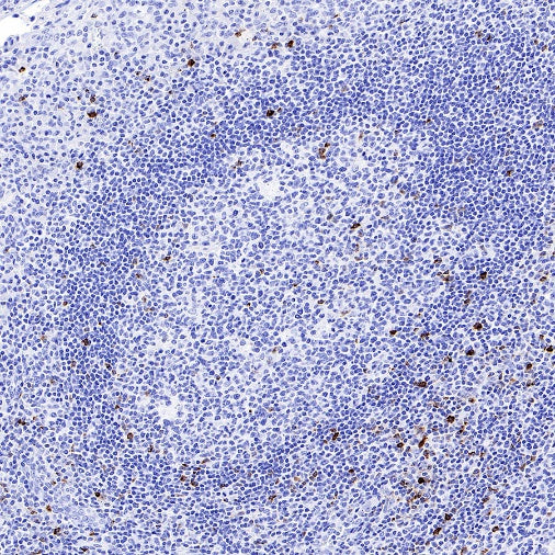 LAG3 Recombinant Rabbit mAb (S-671-74)