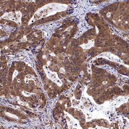 NF-κB p105/p50 Recombinant Rabbit mAb (S-3354)