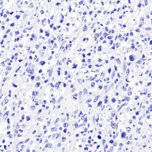 p40 Recombinant Rabbit mAb (SDT-166-116)
