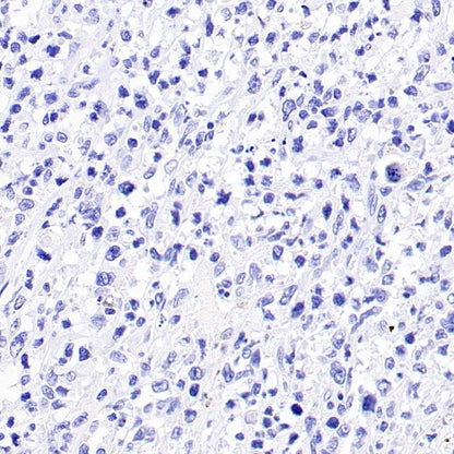 p40 Recombinant Rabbit mAb (SDT-166-116)