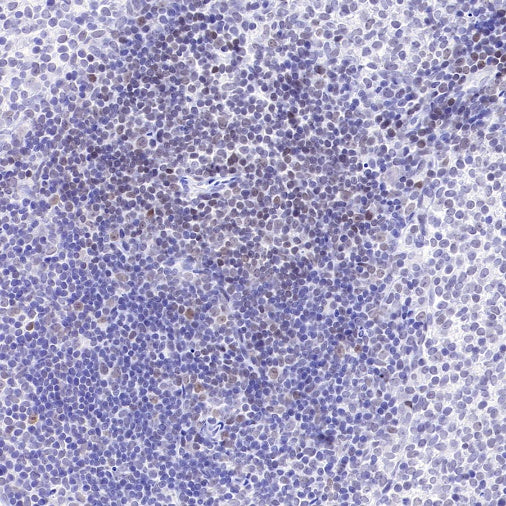 Caspase-8 Recombinant Rabbit mAb (S-2676-74)