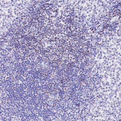 Caspase-8 Recombinant Rabbit mAb (S-2676-74)