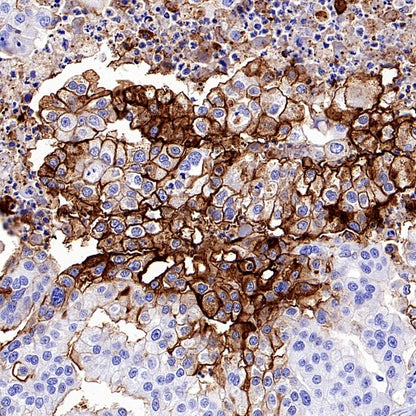 Human folate receptor alpha Recombinant Rabbit mAb (SDT-719-684)