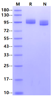 NCAM-1/CD56 (ΔQ609, G610R, M621R) His Tag Protein, Human