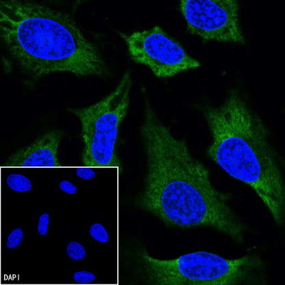 Vinculin Recombinant Rabbit mAb (FITC Conjugate) (S-1635-6)