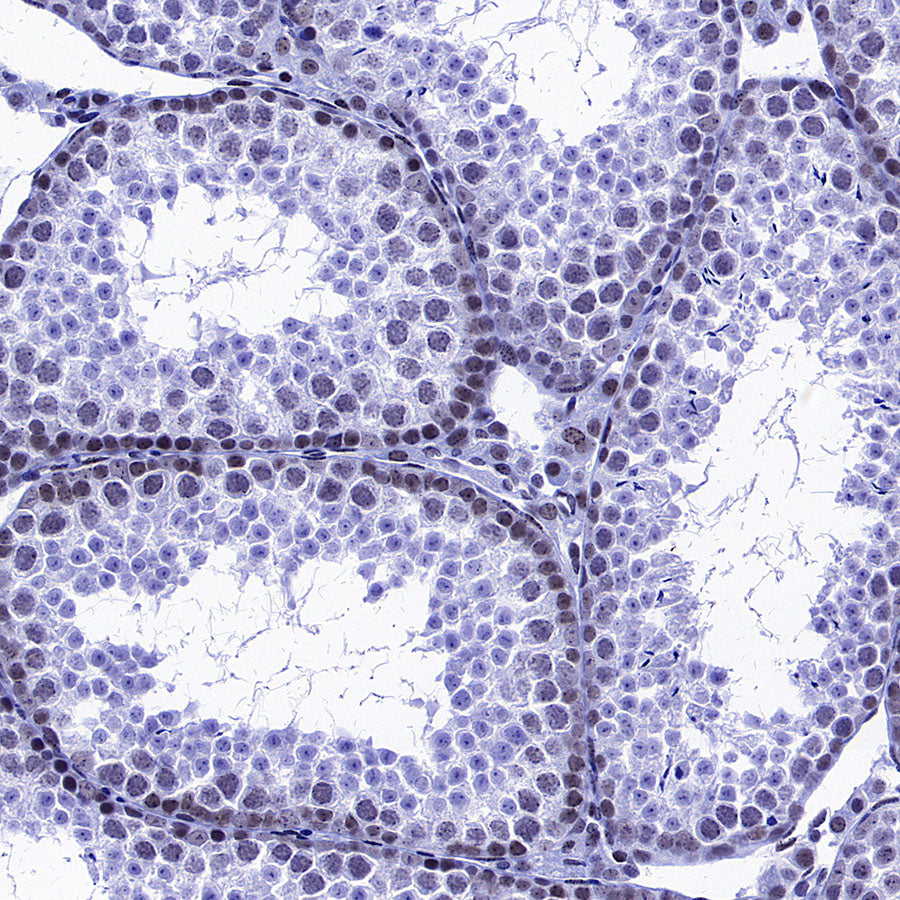 KDM2A Recombinant Rabbit mAb (S-3943-25)