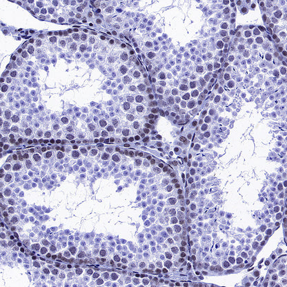 KDM2A Recombinant Rabbit mAb (S-3943-25)