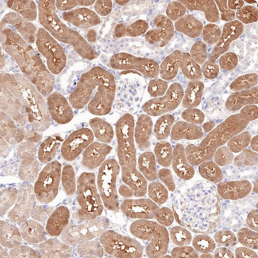 IDH1 Recombinant Rabbit mAb (S-792-16)