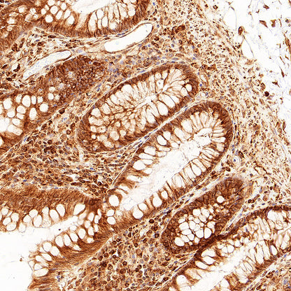 p58IPK/DNAJC3 Recombinant Rabbit mAb (S-4816-205)
