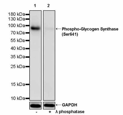 Phospho-Glycogen Synthase (Ser641) Recombinant Rabbit mAb (S-2765-18)